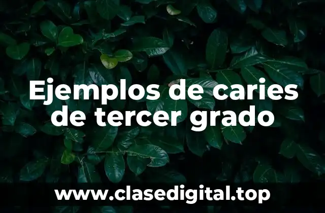 Ejemplos de caries de tercer grado