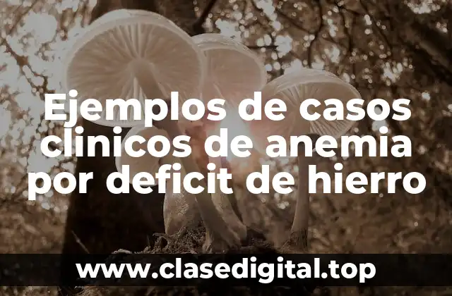 Ejemplos de casos clinicos de anemia por deficit de hierro