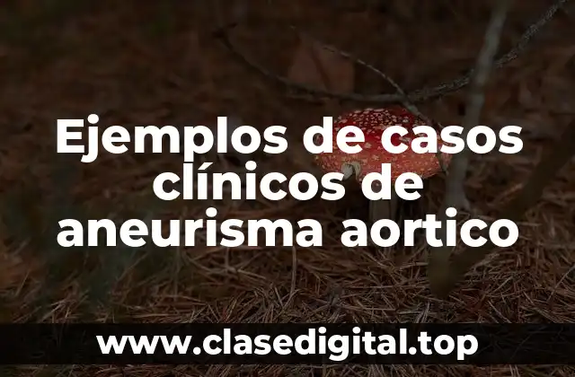 Ejemplos de casos clínicos de aneurisma aortico