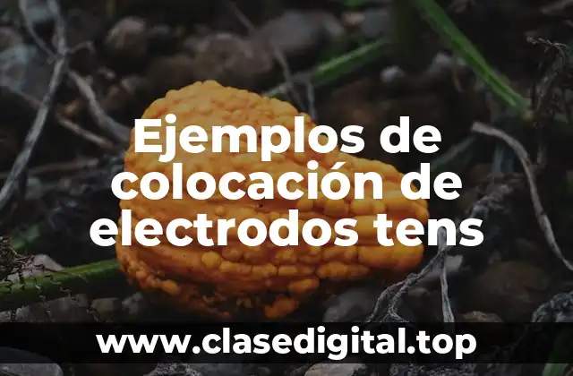 Ejemplos de colocación de electrodos tens
