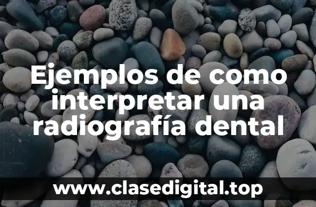 Ejemplos de como interpretar una radiografía dental