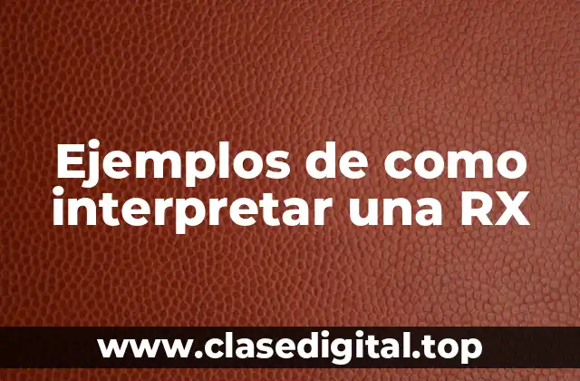 Ejemplos de como interpretar una RX