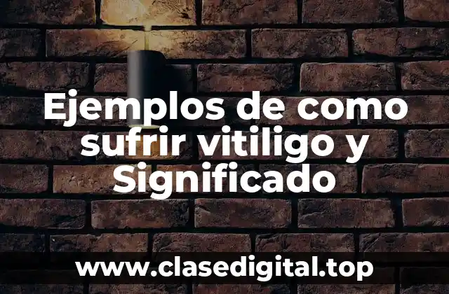 Ejemplos de como sufrir vitiligo y Significado