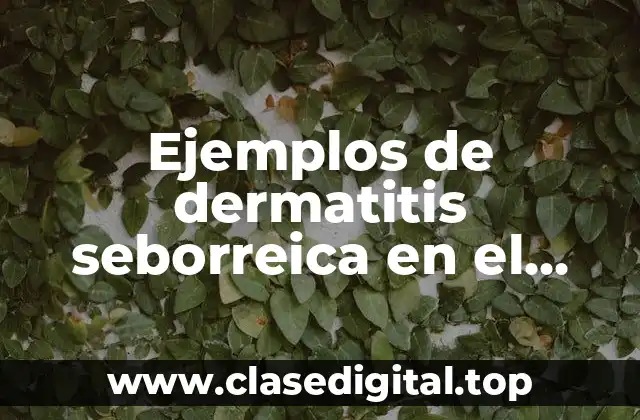 Ejemplos de dermatitis seborreica en el cuero cabelludo