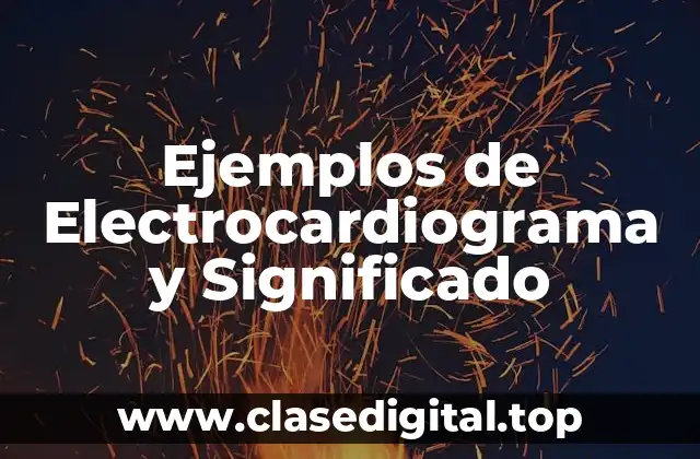 Ejemplos de Electrocardiograma y Significado
