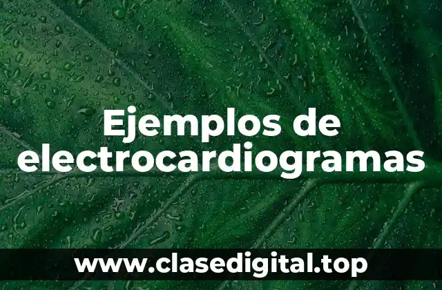 Ejemplos de electrocardiogramas