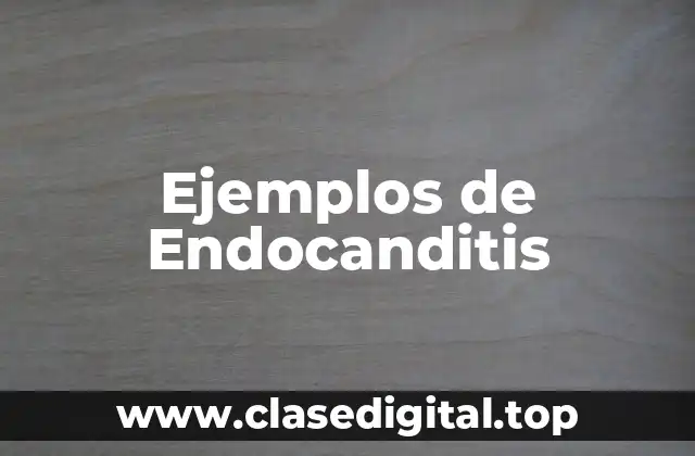 Ejemplos de Endocanditis