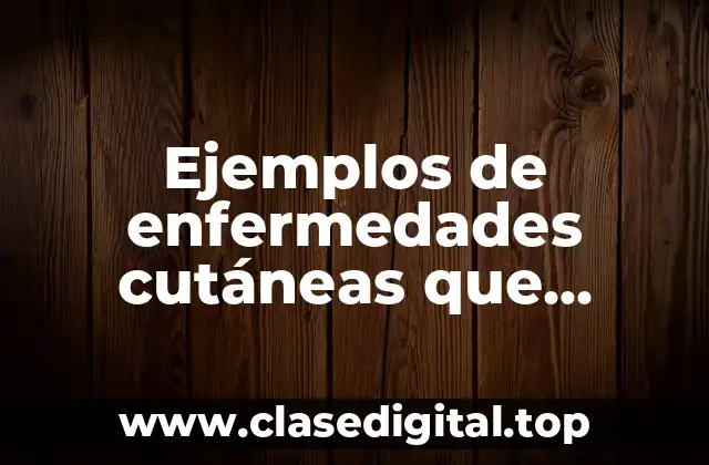 Ejemplos de enfermedades cutáneas que afecten la mucosa bucal