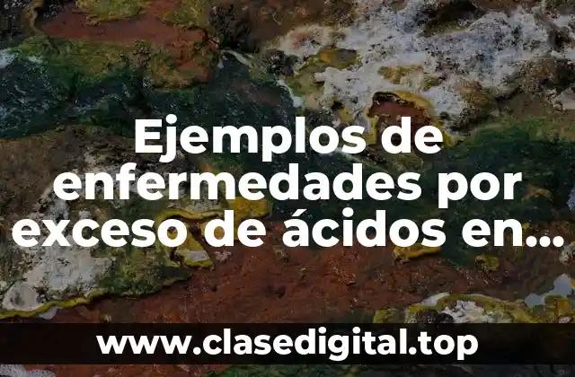 Ejemplos de enfermedades por exceso de ácidos en el estómago