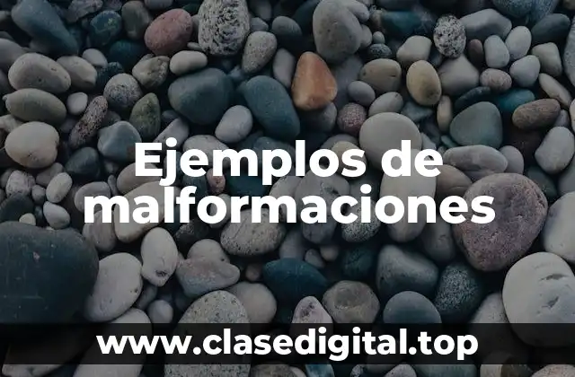 Ejemplos de malformaciones