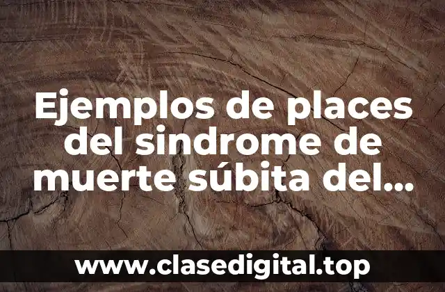 Ejemplos de places del sindrome de muerte súbita del lactante