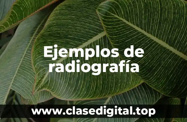 Ejemplos de radiografía