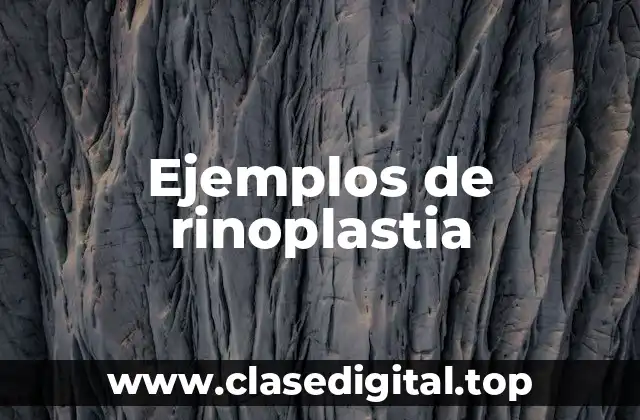 Ejemplos de rinoplastia