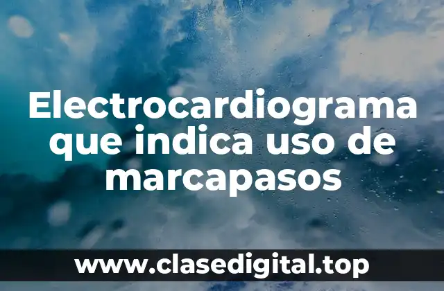 Electrocardiograma que indica uso de marcapasos