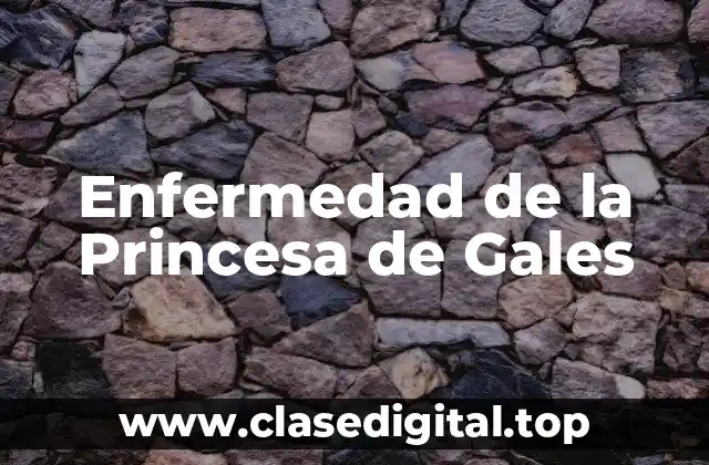Enfermedad de la Princesa de Gales