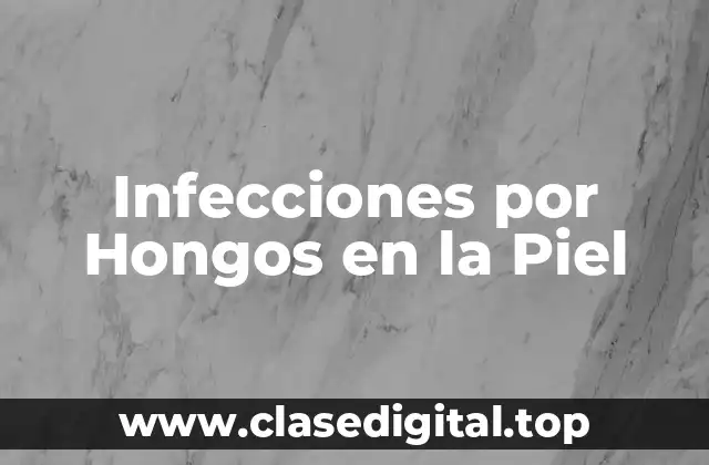 Infecciones por Hongos en la Piel