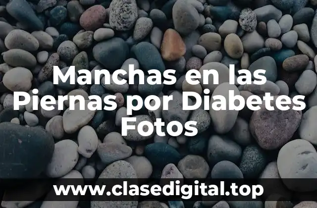 ¿Qué son las Manchas en las Piernas por Diabetes?