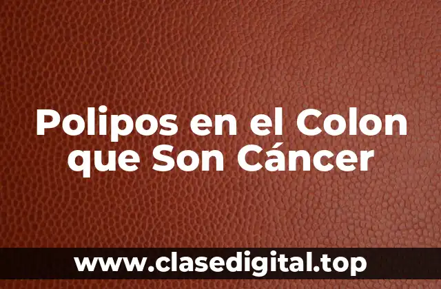 ¿Qué Son los Polipos en el Colon?