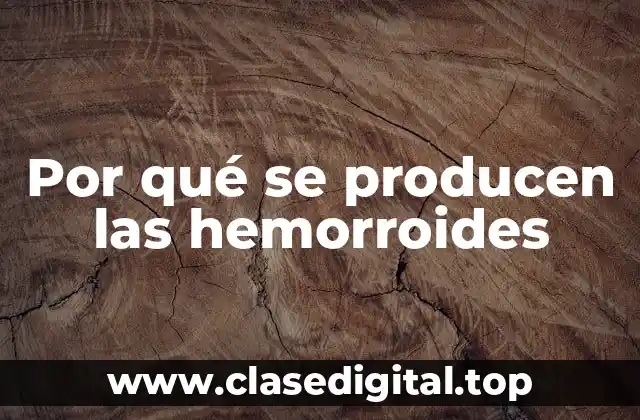 Anatomía de las hemorroides