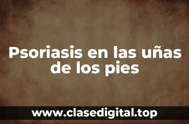 Psoriasis en las uñas de los pies