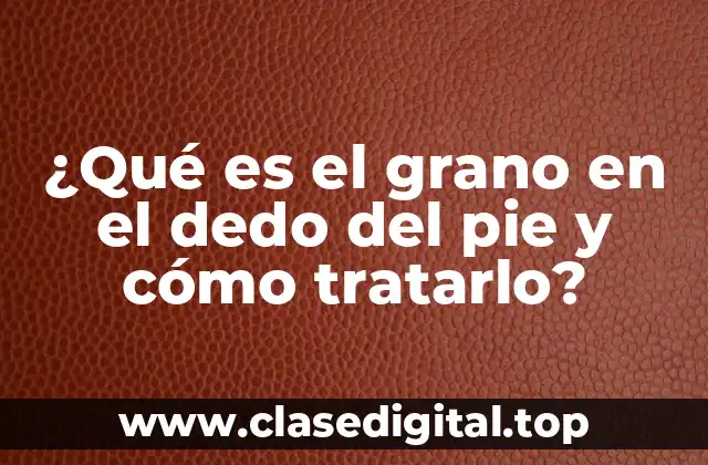 ¿Qué es el grano en el dedo del pie y cómo tratarlo?