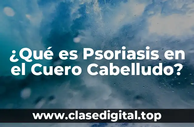 Causas de la Psoriasis en el Cuero Cabelludo