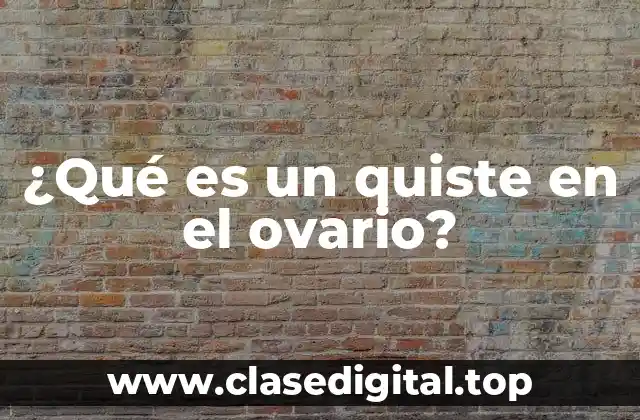 ¿Qué es un quiste en el ovario?