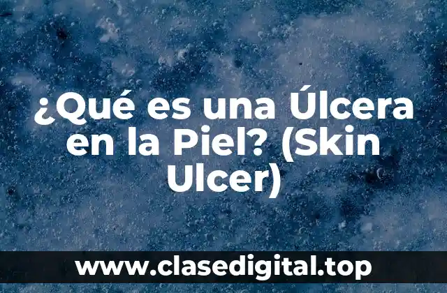 ¿Qué es una Úlcera en la Piel? (Skin Ulcer)