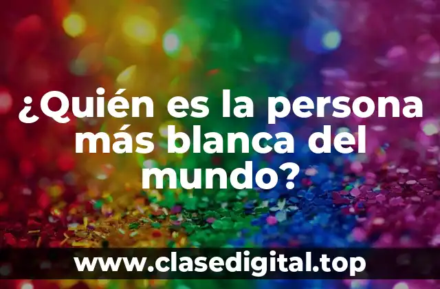 ¿Quién es la persona más blanca del mundo?