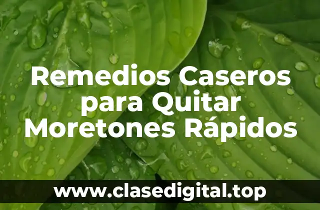Remedios Caseros para Quitar Moretones Rápidos