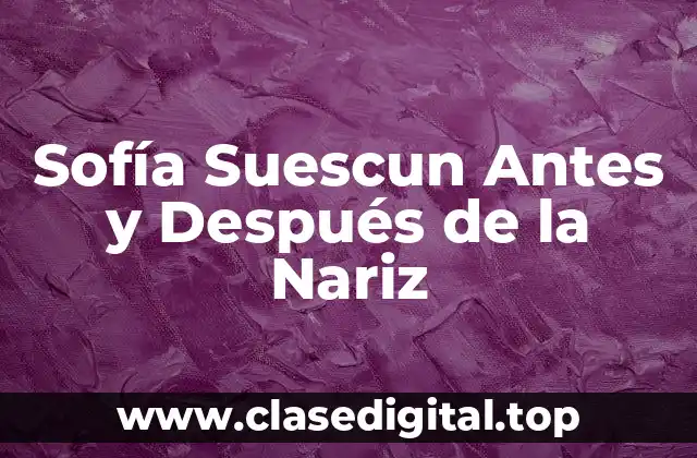 La Vida de Sofía Suescun antes de la Cirugía de Nariz