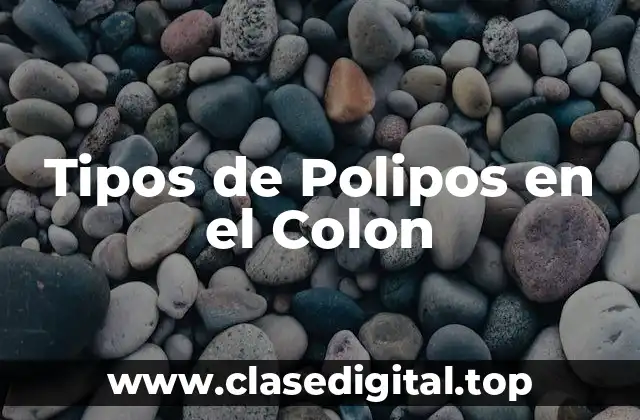 Tipos de Polipos en el Colon