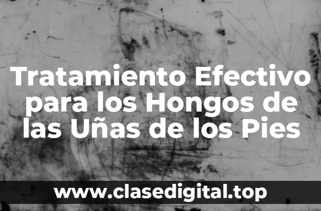 Tratamiento Efectivo para los Hongos de las Uñas de los Pies