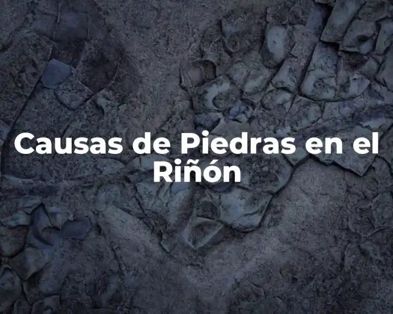 Causas de Piedras en el Riñón