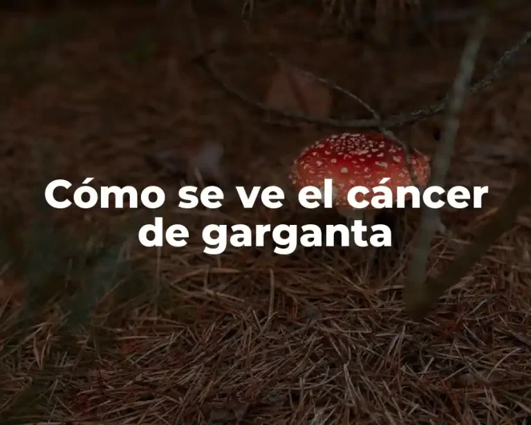 Cómo se ve el cáncer de garganta