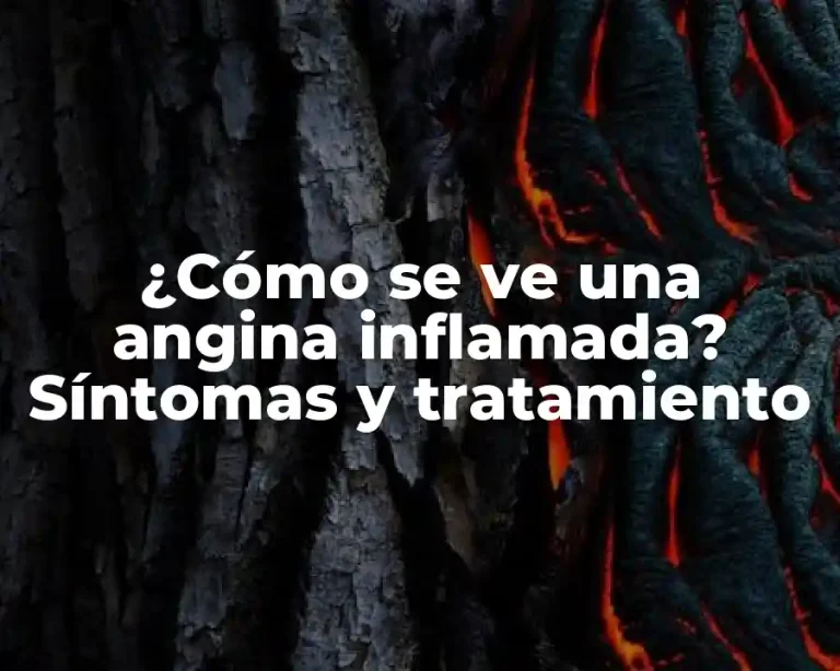 ¿Cómo se ve una angina inflamada? Síntomas y tratamiento