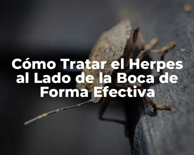 Cómo Tratar el Herpes al Lado de la Boca de Forma Efectiva