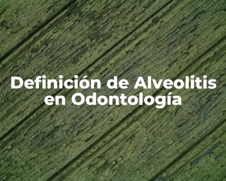Definición de Alveolitis en Odontología