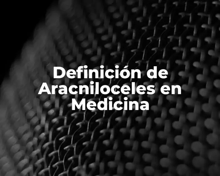 Definición de Aracniloceles en Medicina