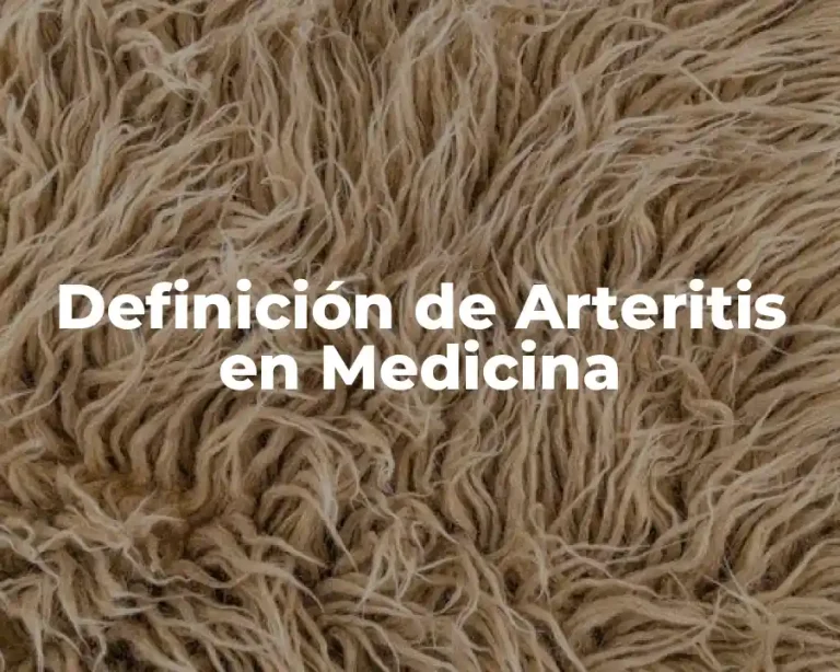 Definición de Arteritis en Medicina
