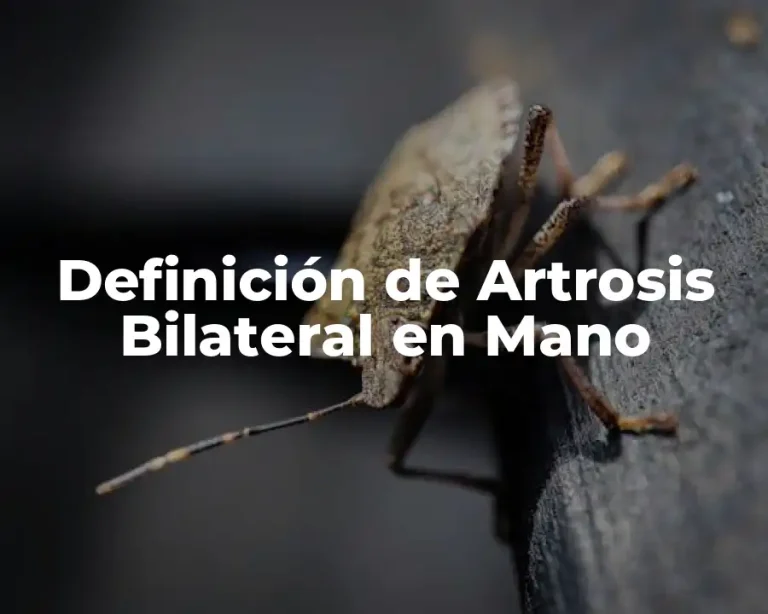 Definición de Artrosis Bilateral en Mano