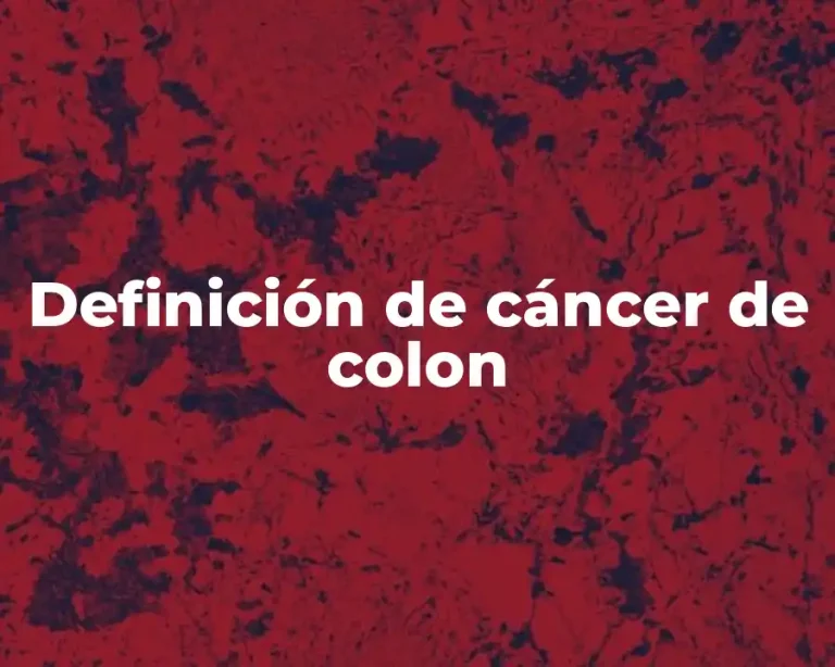 Definición de cáncer de colon