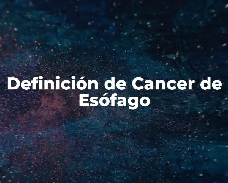 Definición de Cancer de Esófago