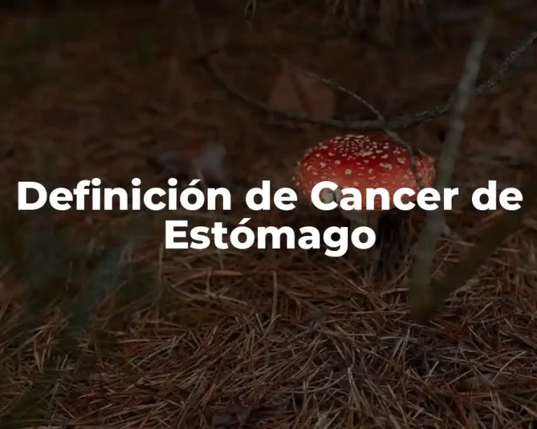 Definición de Cancer de Estómago