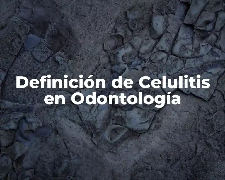 Definición de Celulitis en Odontología