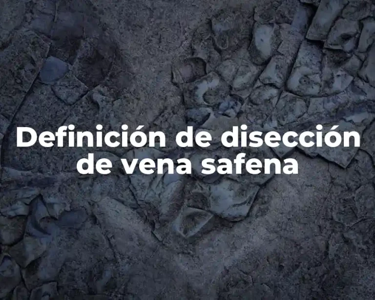 Definición de disección de vena safena