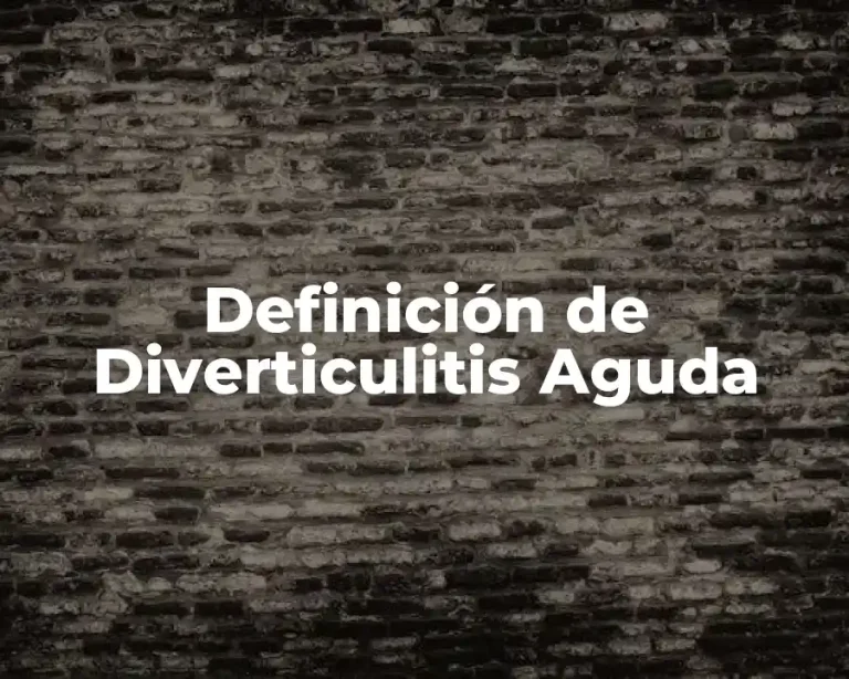 Definición de Diverticulitis Aguda