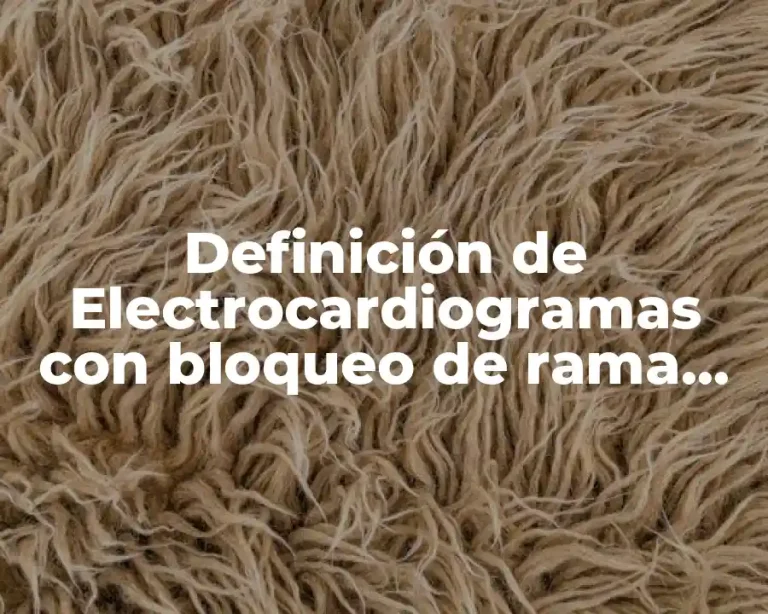 Definición de Electrocardiogramas con bloqueo de rama izquierda