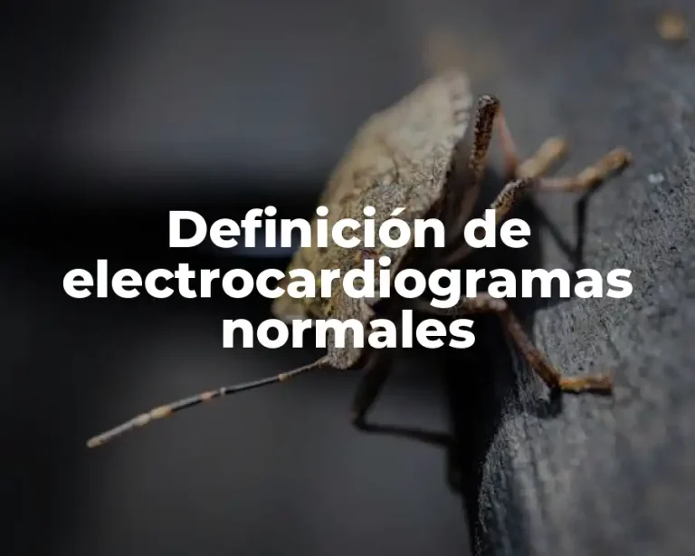 Definición de electrocardiogramas normales