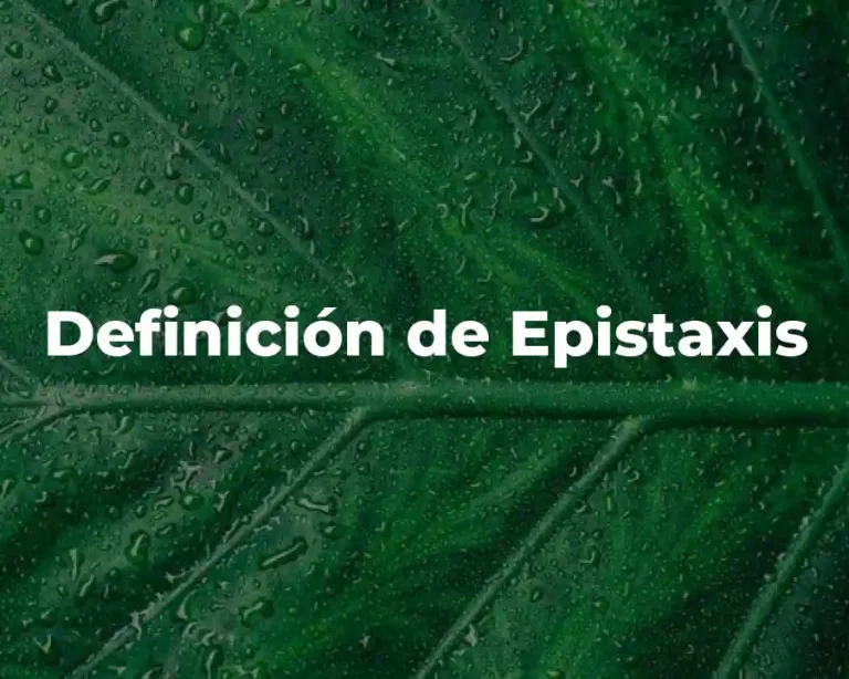 Definición de Epistaxis